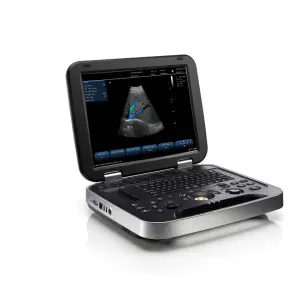 15 Inch HD LED Display Portable Ultrasound Machine Sen Factory Direct Sale Reasonable Price
