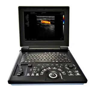 SONOSCOPE UM-SN-X3 E20 Electric Medical Ultrasound Machine Color Doppler Echocardiography Convex Probe High Resolution 12-inch