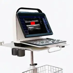 Reliable Portable Color Doppler Clear Imaging with Easy Operation for Mobile Healthcare