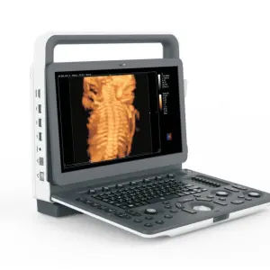 Portable Color Doppler Ultrasound UMUS081 3D/4D/5D Imaging for Abdomen/Cardiology
