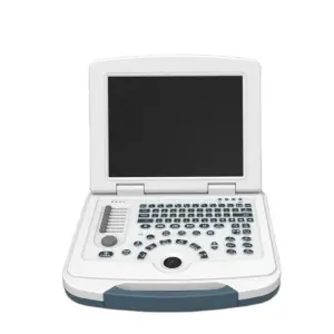 Ultrasonic Diagnostic System for Laptop Color Medical Ultrasound Hospital Obstetrics Surgery Monitor Convex Probe Electric Power