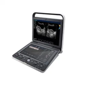S9 Portable Color Doppler Ultrasound Dual Screen 10 Imaging Modes 500GB ECG