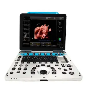 12.1 Inch 4D 3D Diagnostic Ultrasound Machine Color Doppler Ultrasound Machine