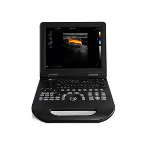 Portable Human Vet 2d 3d 4d Medical Ultrasound Machine Color Doppler