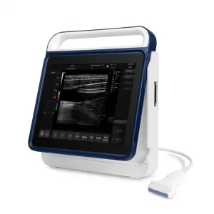 Portable Vet Ultrasound Machine Veterinary Ultrasound Ovum Pick-Up Egg Collection Ultrasound Scanner