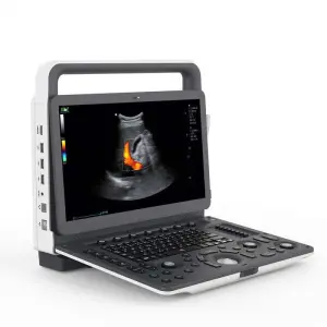 Medical Ultrasonido Diagnostic System 4D Color Doppler Ultrasound Machine with Three Probe Interface