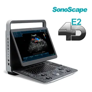 SonoScape E2 Color Doppler Echo Machine Ultrasound Machine USG with TDI CW PW Function