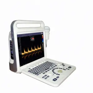 Medical Ecografo Portatil Doppler Cardiac 3d 4d Ultrasound Machine for Gynecology
