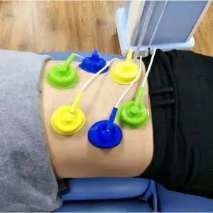 Neuromuscular Electrical Stimulator Machine Middle Frequency Interference Therapy Physical Therapy Equipment
