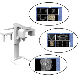 CBCT 3D Dental Imaging, Dental Cone Beam CT MSLDX12